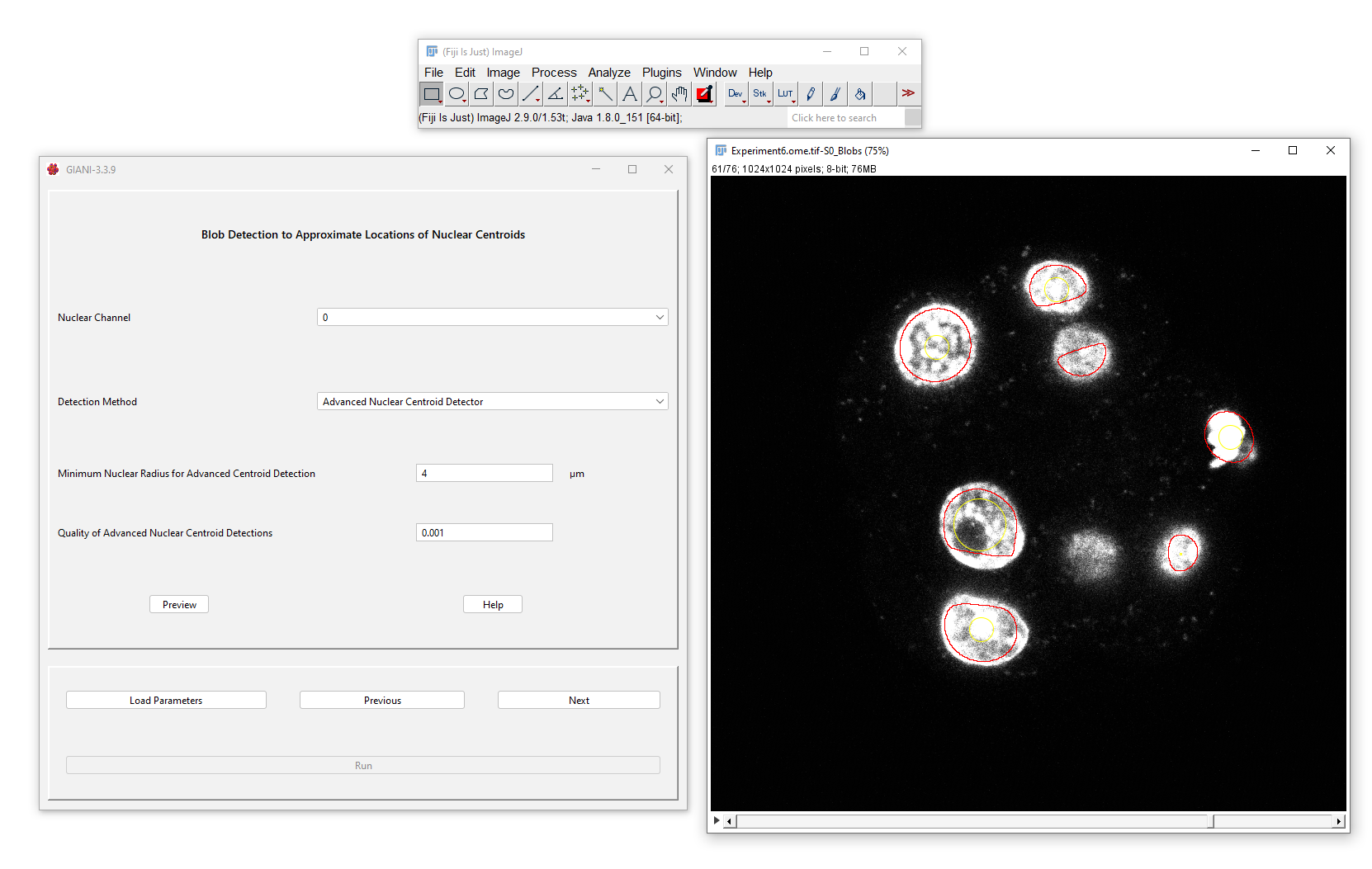 GIANI Detect Nuclei Centres Preview