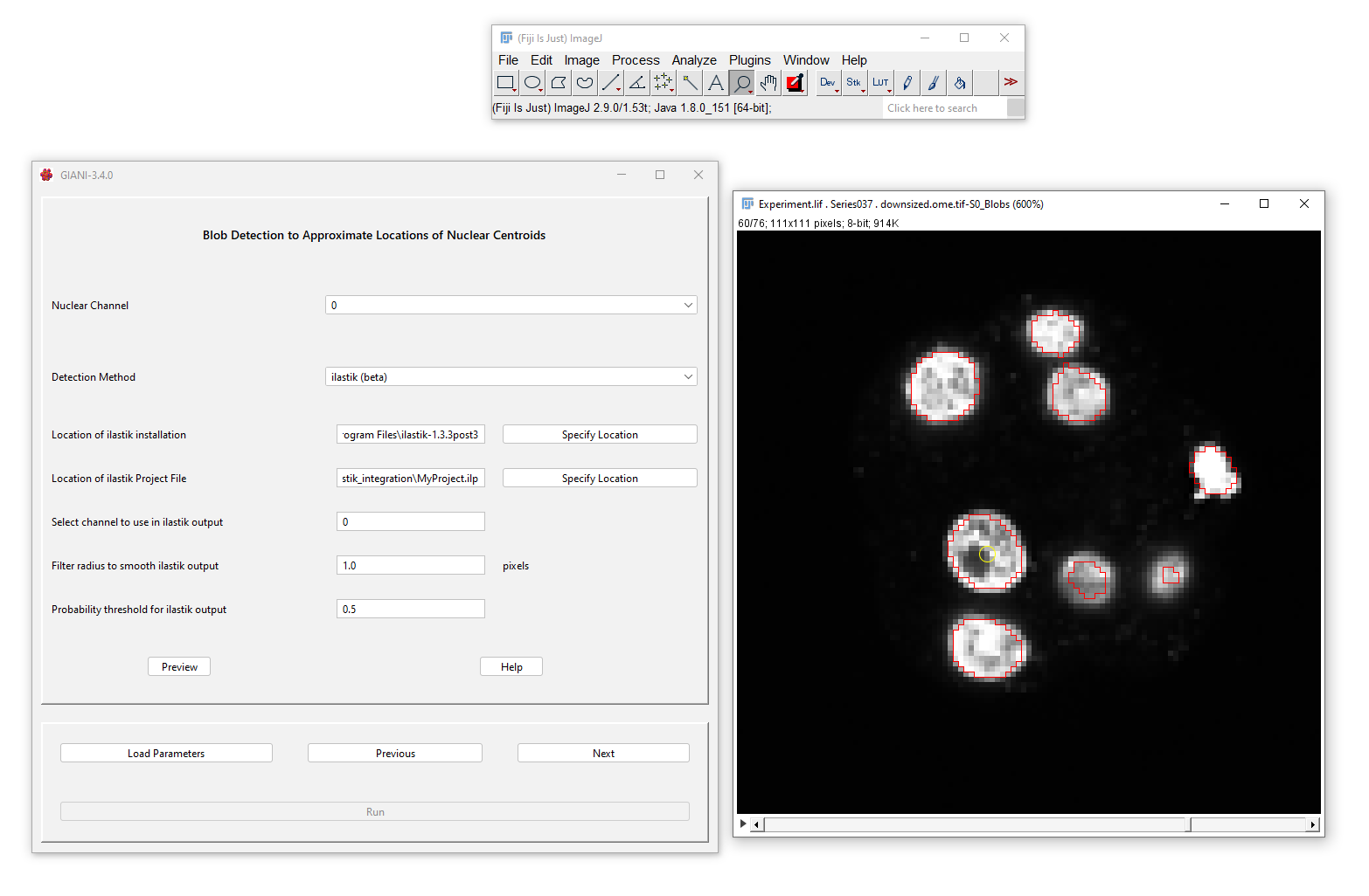 GIANI Detect Nuclei Centres Preview