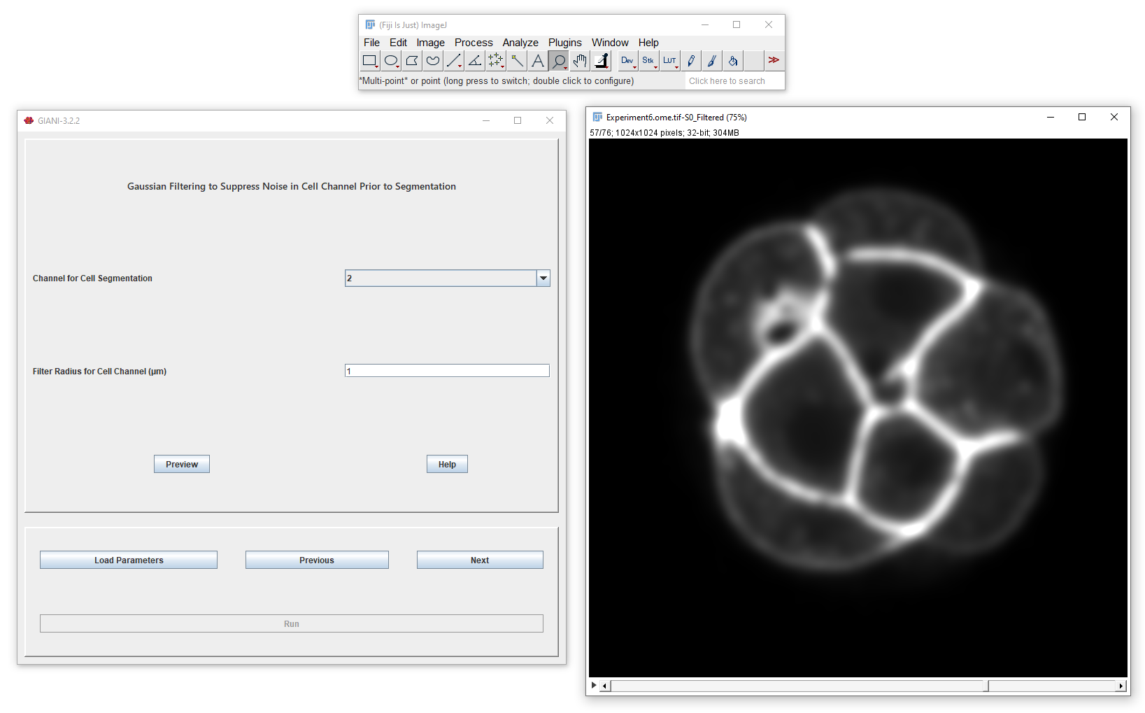 Filtering for cell segmentation