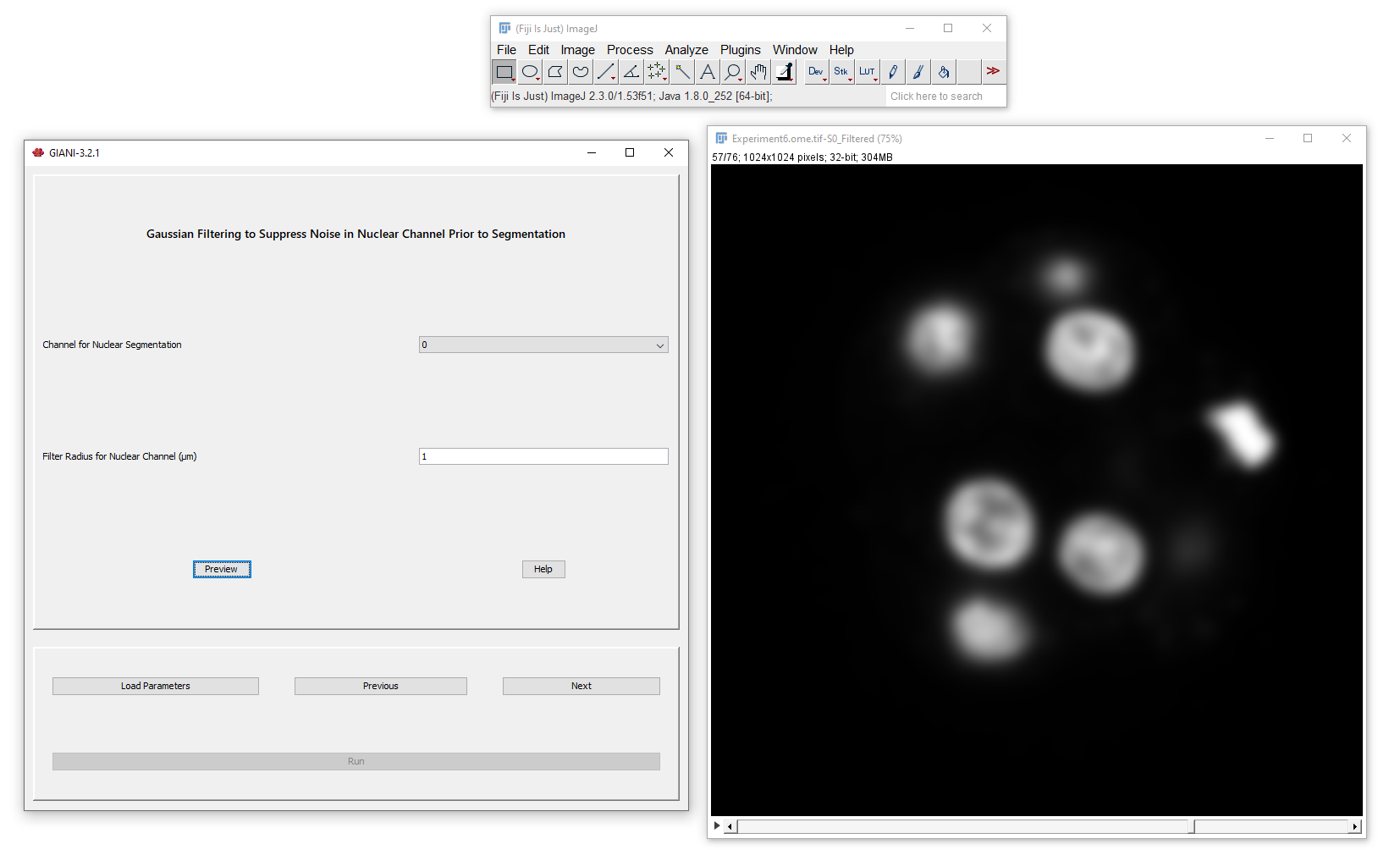 Filtering for nuclear segmentation